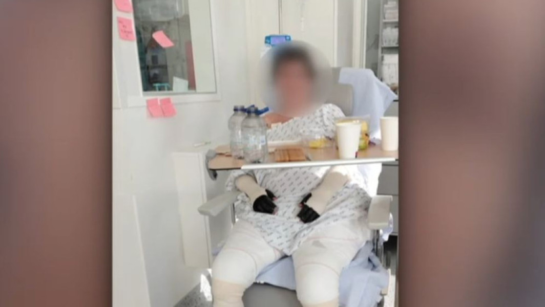 Pacienta cu arsuri grave de la Floreasca, externată după tratament în Belgia
