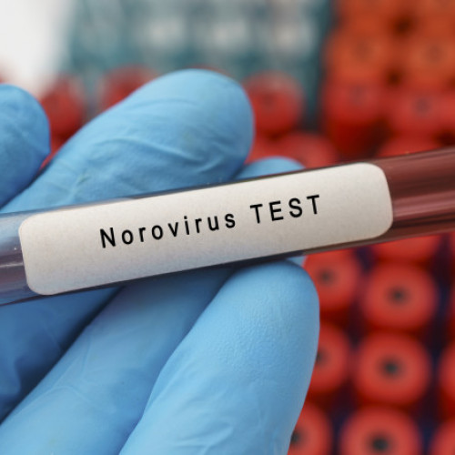 Norovirusul afectează liceul din Timișoara prin dureri și simptome digestive. Infecția se răspândește rapid și persistă câteva zile, iar igienizarea suprafețelor este esențială